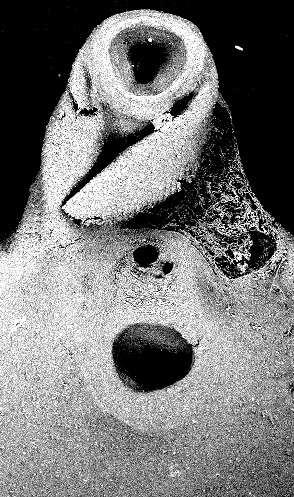 Расположенные по одной линии ротовая, половая и брюшная присоски трематоды Fаsciola hepatica Linnaeus, 1758: А, Б, В – фиксированные и окрашенные мариты; Г – марита после фиксации и отмывания в течение двух дней в воде (РЭМ) 