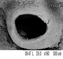 Брюшная присоска: А – обычное положение; Б – после фиксации