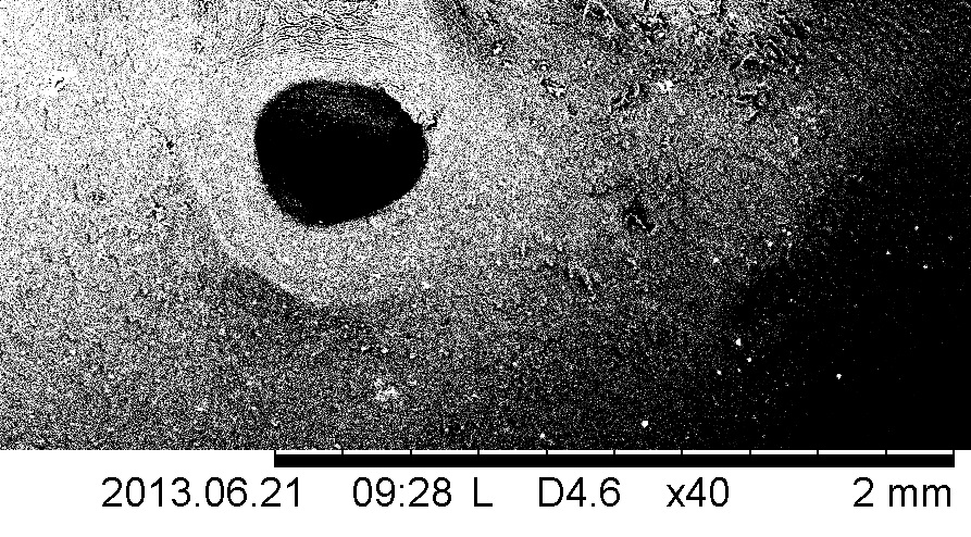 Брюшная присоска: А – обычное положение; Б – после фиксации
