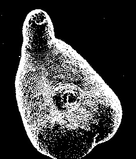 Однодневная Fаsciola hepaticа: А – первый день жизни на стенках желчных протоков печени (фото проф. J. T. Sanchez–Vega, Mexico); Б – брюшная присоска