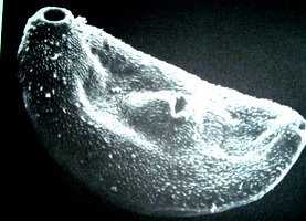 Брюшная присоска трехдневной Fasciola hepatica