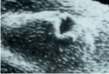 Брюшная присоска трехдневной Fasciola hepatica