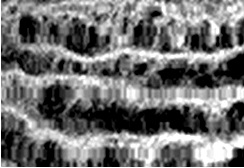 Мышцы брюшной присоски: А – дисковидная форма; Б – продольные и поперечные мышечные волокна