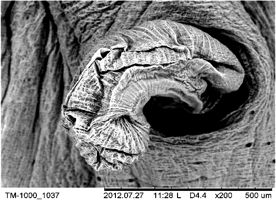Отслоение мышечного кольца брюшной присоски (РЭМ х 200)