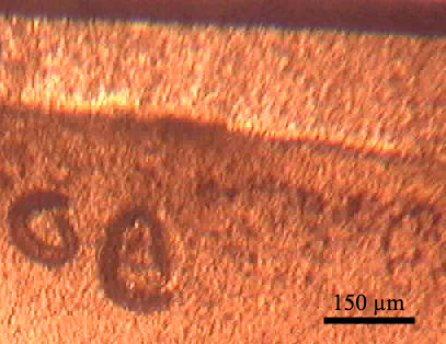 The foot of Helix pomatia experimentally infected with Protostrongylidae