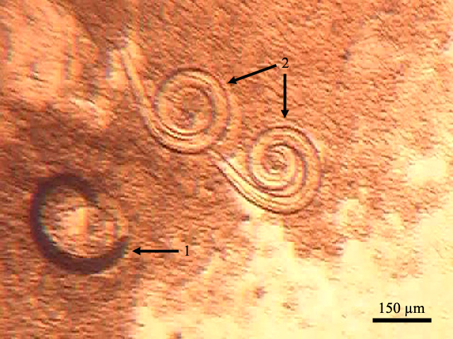 The foot of Helix pomatia experimentally infected with Protostrongylidae