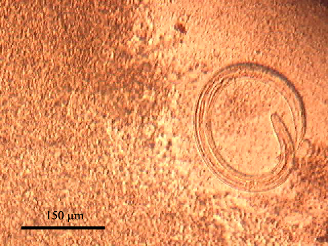The foot of Helix pomatia experimentally infected with Protostrongylidae