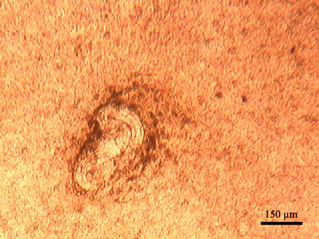 The foot of Helix pomatia experimentally infected with Protostrongylidae