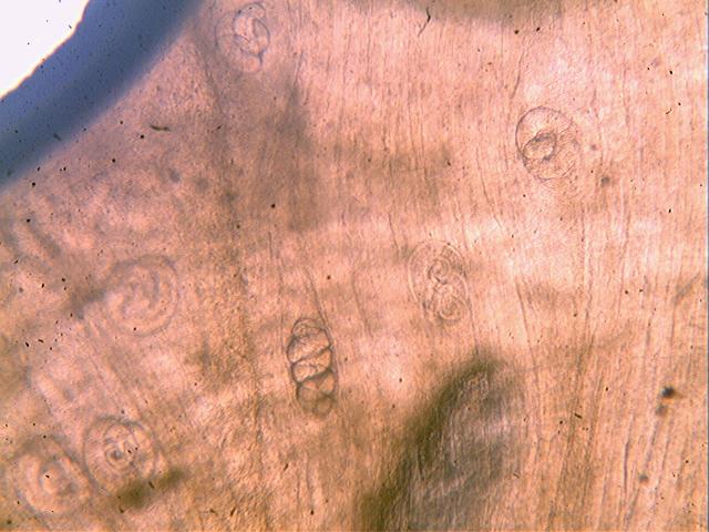 Личинки T. nativa в мышечной ткани южного ежа (микрофото, ув. объектив PL10/0,25, окуляр WF10Х/22, ориг.)